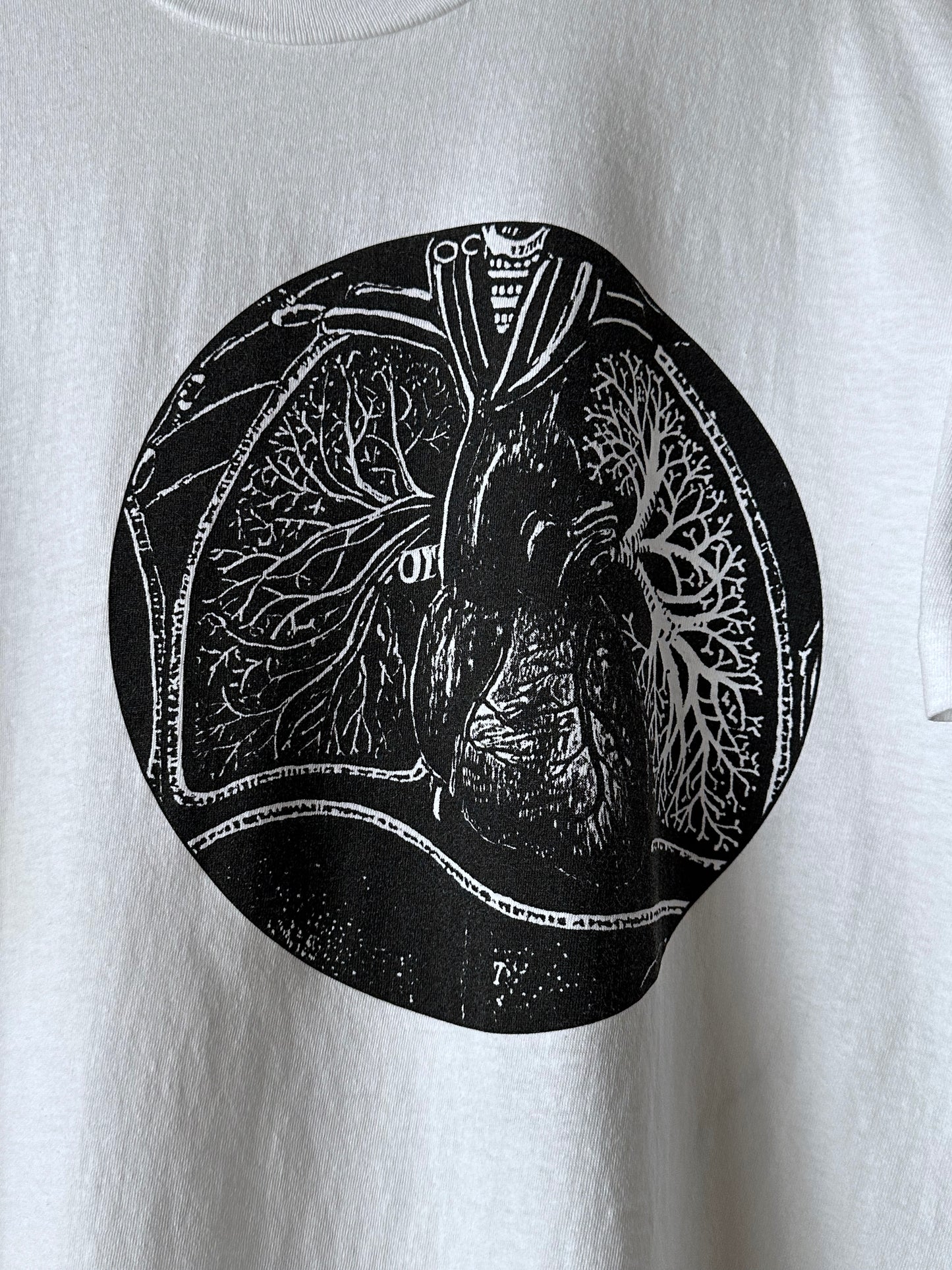 Fontanelle 1993 - L
